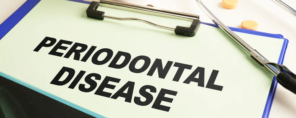 歯周病（PERIODONTAL DISEASE）と書かれた診療用ボード｜戸塚モディシティデンタルクリニック