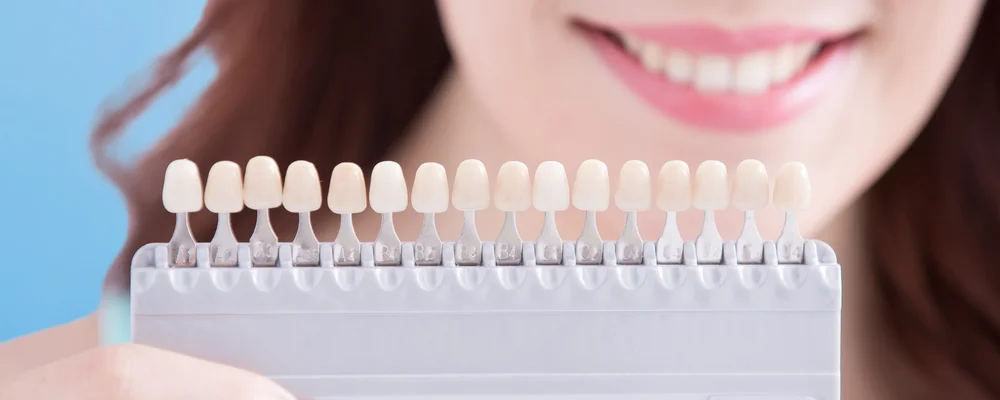 歯の色の段階を示すシェードガイドの接写｜戸塚モディシティデンタルクリニック